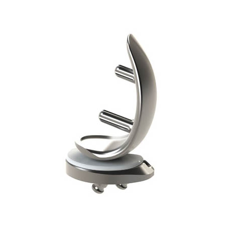 STRIDE unicondylar knee: image from Blue Belt Technologies